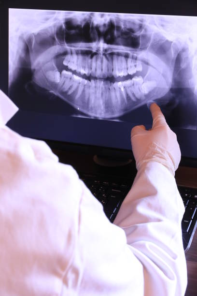 Best Emergency Treatment for Oral Infections in Midwest City, OK