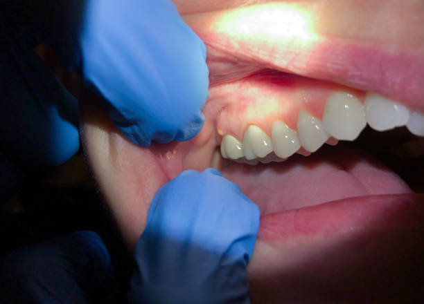 Best Emergency Denture Repair in Midwest City, OK