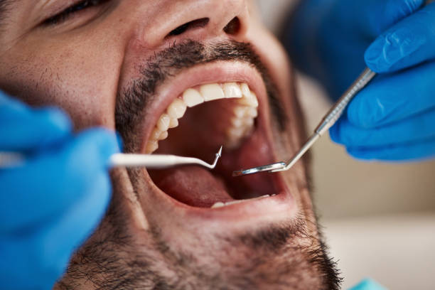 Best Urgent Dental Care for Toothaches in Midwest City, OK
